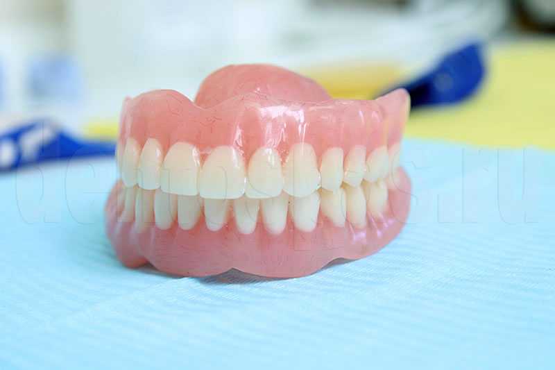 Съемные зубные протезы: какие лучше