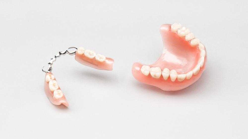 Лучшие кремы для фиксации зубных протезов по мнению стоматологов и по отзывам пациентов Достоинства, недостатки, цены